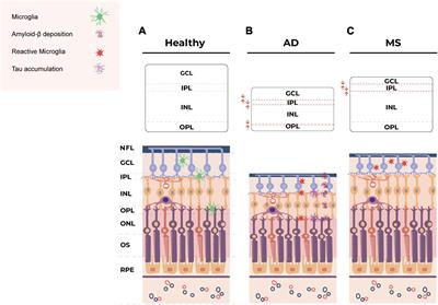 Non-invasive in vivo imaging of brain and retinal microglia in neurodegenerative diseases